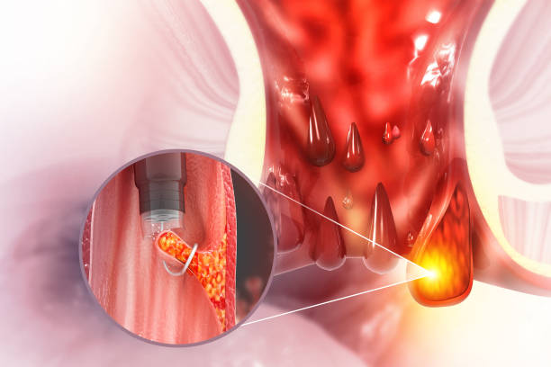  Механизм питания поджелудочной железы в кишечном тракте
