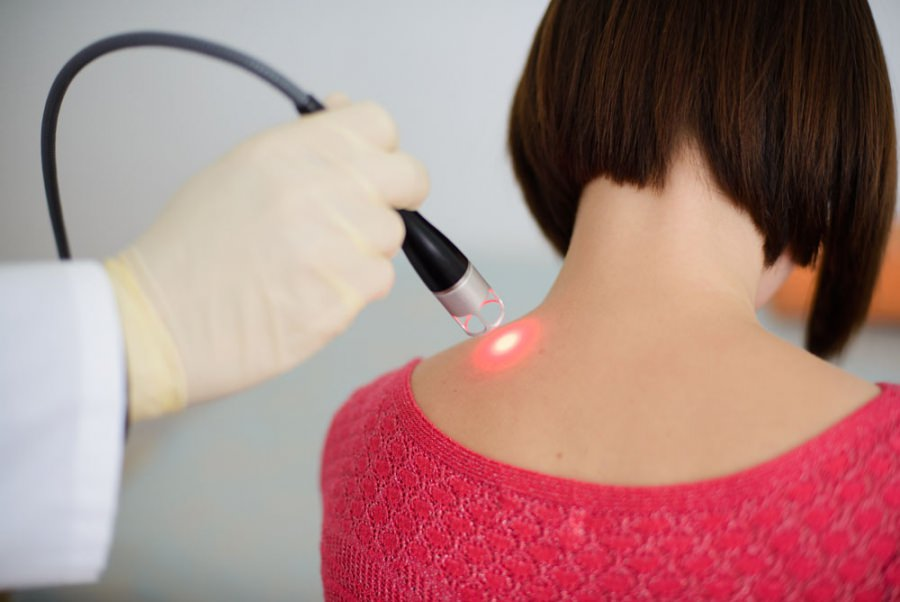 A person receives a laser treatment on their upper back.